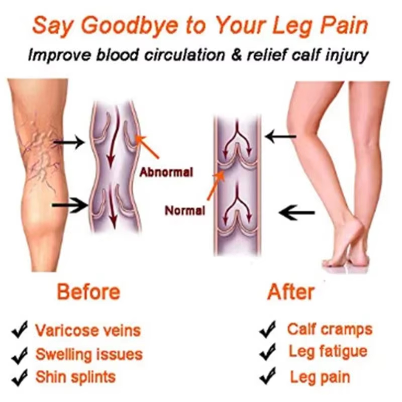 جوارب ضاغطة للنساء والرجال للر - مراجعة Compression Sleeve Calf وسعره